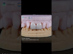 自然プレスされたEMAXファニヤ 16色 エマックス歯のファニヤ
