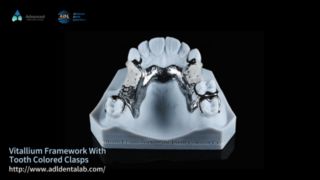 Vitallium フレームワーク ナチュラルエステ イージーフィット