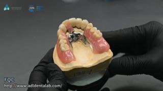 望遠鏡クラウンの精密はんだ付け品質