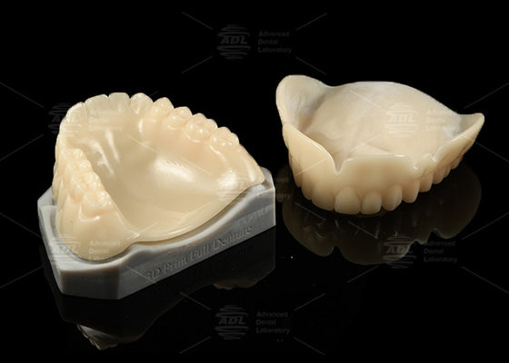 購入 3Dプリント 歯科 試用 バイオコンパティブル A1/A2/A3 完璧なフィット 閉塞 オンライン製造