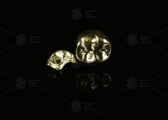 購入 宝石合金 黄金 60% フルメタルクラウン ゴールド 仕上げ フルメタルクラウン オンライン製造