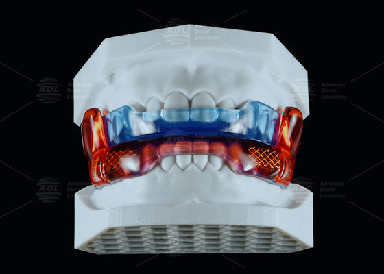 購入 睡眠改善のための医療グレードのシリコン抗くしゃみ器 RP オンライン製造