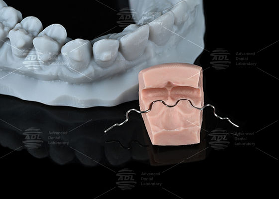 購入 中国 歯科 実験室 視界 強い U 形 舌 線 保持 単鎖 矯正 治療 の 快適 レベル オンライン製造