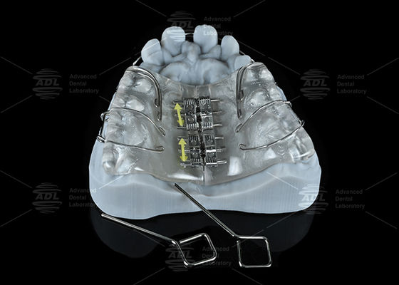 購入 中国歯科ラボ カラフルステンレス鋼スクリューエキスパンダー 上顎・下顎拡大用 オンライン製造