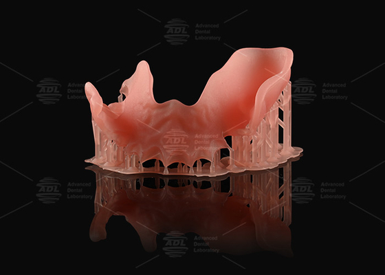 オレンジ ピンク アクリル 部分 歯入れ 自然 見た 3D プリント デジタル 歯入れ