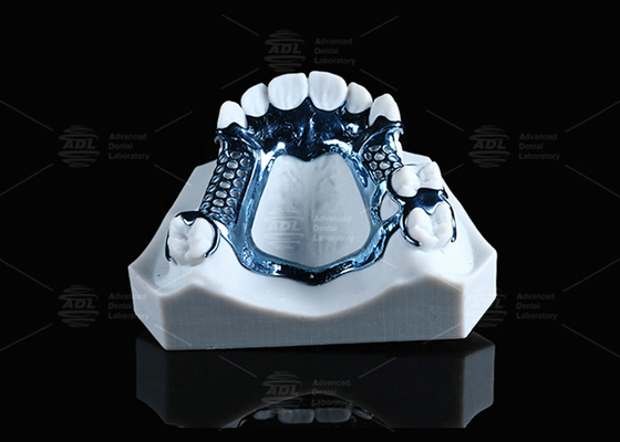 アノジス 3D プリント タイタンのフレーム 軽量で敏感な皮膚に適しています