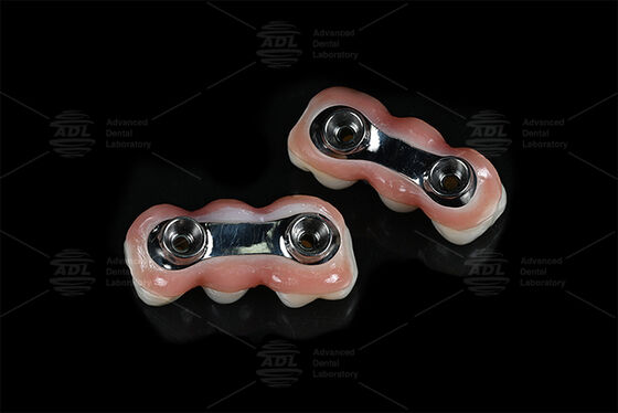 強化インプラントバー CAD CAM 精密なフィットのために設計されています ほとんどの歯科インプラントシステムと互換性 歯科復旧ソリューションを保証します 中国歯科ラボ