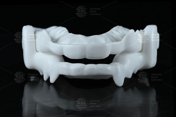 医療グレードナイロン咬合スプリントナイトガード、研削防止のための柔軟なCAD/CAMデザイン